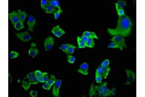 Immunofluorescence staining of MCF-7 cells with ABIN7163593 at 1:200, counter-stained with DAPI. (GP6 抗体  (AA 115-265))