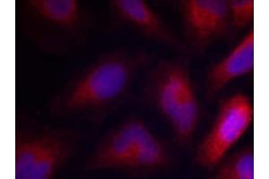 Immunofluorescence staining of methanol-fixed HeLa cells using MARCKS (Phospho-Ser162) Antibody (E011265, Red) (MARCKS 抗体  (pSer162))
