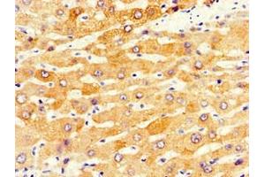 Immunohistochemistry (IHC) image for anti-Cytochrome P450, Family 1, Subfamily A, Polypeptide 2 (CYP1A2) (AA 268-445) antibody (ABIN7149206)