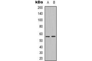 Western blot analysis of NPY5R expression in Jurkat (A), HepG2 (B) whole cell lysates. (NPY5R 抗体)