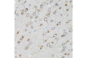 Immunohistochemistry of paraffin-embedded rat brain using UBE2D1 antibody (ABIN3015751, ABIN3015752, ABIN3015753 and ABIN6219101) at dilution of 1:100 (40x lens). (UBE2D1 抗体  (AA 1-147))