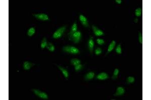 Immunofluorescence staining of Hela cells with ABIN7155794 at 1:133, counter-stained with DAPI. (MKX 抗体  (AA 157-305))
