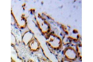 anti-Adiponectin Receptor 1 (ADIPOR1) (AA 1-136) antibody