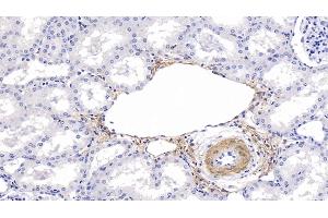 Immunohistochemistry (IHC) image for anti-Actin, Alpha, Cardiac Muscle 1 (ACTC1) (AA 156-368) antibody (ABIN7428392)