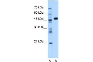 GPT antibody used at 1. (ALT 抗体)
