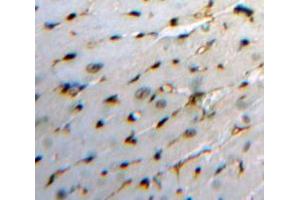 Used in DAB staining on fromalin fixed paraffin-embedded Heart tissue (HBEGF 抗体  (AA 21-160))