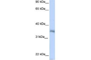 WB Suggested Anti-HEXIM2 Antibody Titration:  0. (HEXIM2 抗体  (N-Term))