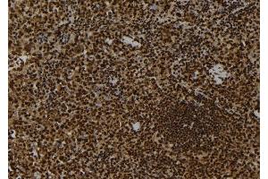 ABIN6263111 and ABIN6278722 at 1/100 staining Mouse spleen tissue by IHC-P. (MAP3K9 抗体  (C-Term))