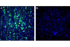 Expression of KCa2. (KCNN1 抗体  (Intracellular))