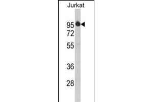 Western blot analysis of HTATSF1 Antibody (N-term) (ABIN390597 and ABIN2840915) in Jurkat cell line lysates (35 μg/lane). (HTATSF1 抗体  (N-Term))