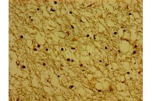 Immunohistochemistry of paraffin-embedded human brain tissue using ABIN7171138 at dilution of 1:100 (Synaptoporin 抗体  (AA 199-265))