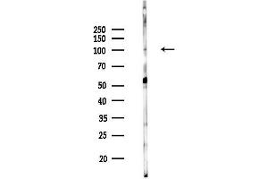 Western blot analysis of lysates from MCF7 cells(heat-shock,45 min treatment), using  Antibody at 1/1000 dilution.