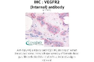 Image no. 1 for anti-VEGF Receptor 2 (VEGFR2) (Internal Region) antibody (ABIN1740694)
