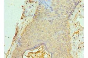 Immunohistochemistry of paraffin-embedded human skin tissue using ABIN7143053 at dilution of 1:100