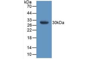 Detection of Recombinant GSTt1, Mouse using Polyclonal Antibody to Glutathione S Transferase Theta 1 (GSTt1) (GSTT1 抗体  (AA 7-240))