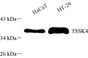 Western blot analysis of TSSK4 (ABIN7075865) at dilution of 1: 500 (TSSK4 抗体)