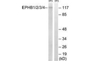 Western blot analysis of extracts from NIH-3T3 cells, treated with heat shock, using EPHB1/2/3/4 (Ab-600/602/614/596) Antibody. (EPH Receptor B1/2/3/4 (AA 566-615) 抗体)