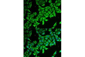 Immunofluorescence analysis of MCF-7 cells using DAP antibody. (DAP 抗体)