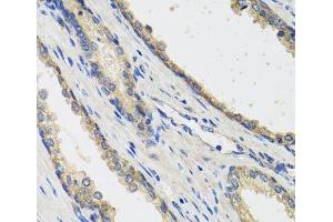 Immunohistochemistry of paraffin-embedded Human prostate using RAD51C Polyclonal Antibody at dilution of 1:100 (40x lens).