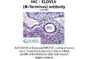 Image no. 2 for anti-ELOVL Fatty Acid Elongase 5 (ELOVL5) (N-Term) antibody (ABIN1733973) (ELOVL5 抗体  (N-Term))