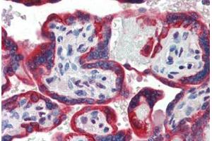 Human Placenta (formalin-fixed, paraffin-embedded) stained with SP3 antibody ABIN462188 followed by biotinylated goat anti-rabbit IgG secondary antibody ABIN481713, alkaline phosphatase-streptavidin and chromogen. (Sp3 抗体  (AA 287-336))