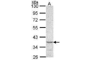 WB Image Sample (30 ug of whole cell lysate) A: A549 10% SDS PAGE antibody diluted at 1:1000 (CYTIP 抗体  (N-Term))