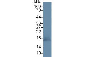 Detection of PRDX5 in Mouse Kidney lysate using Polyclonal Antibody to Peroxiredoxin 5 (PRDX5) (Peroxiredoxin 5 抗体  (AA 49-210))