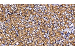 Detection of CASP1 in Mouse Kidney Tissue using Polyclonal Antibody to Caspase 1 (CASP1) (Caspase 1 抗体  (AA 317-404))