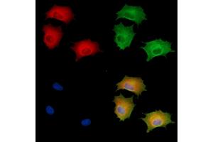 ABIN6261381 and ABIN6278681 staining  cells by IF/ICC.