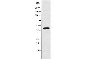 Western blot analysis of extracts from Jurkat cells using ARRDC3 antibody. (ARRDC3 抗体  (C-Term))