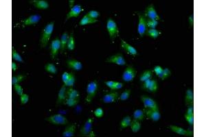 Immunofluorescence (IF) image for anti-Colony Stimulating Factor 2 Receptor, Beta (CSF2RB) (AA 492-710) antibody (ABIN7149290)