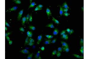 Immunofluorescence staining of Hela cells with ABIN7149290 at 1:66, counter-stained with DAPI. (CD131 抗体  (AA 492-710))
