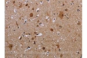 The image on the left is immunohistochemistry of paraffin-embedded Human brain tissue using ABIN7191347(MAGEB18 Antibody) at dilution 1/20, on the right is treated with synthetic peptide. (MAGEB18 抗体)