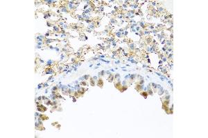 Immunohistochemistry of paraffin-embedded mouse lung using PI3 antibody (ABIN6132804, ABIN6145588, ABIN6145590 and ABIN6221092) at dilution of 1:100 (40x lens). (PI3 抗体  (AA 23-117))