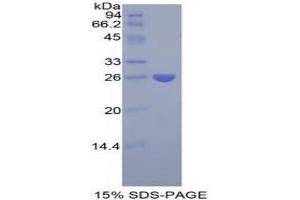 SDS-PAGE analysis of Human Pentraxin 3 Protein. (PTX3 蛋白)