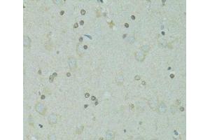 Immunohistochemistry of paraffin-embedded Rat brain using GTF2H2C Polyclonal Antibody at dilution of 1:100 (40x lens). (GTF2H2C 抗体)