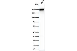 Western Blotting (WB) image for anti-Spectrin, Beta, Non-erythrocytic 2 (SPTBN2) (AA 356-475) antibody (ABIN6940652)