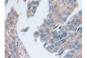 Immunohistochemistry (IHC) image for anti-Utrophin (UTRN) (AA 1-252) antibody (ABIN7443953)