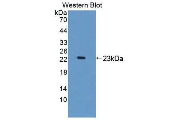 KTN1 抗体  (AA 1162-1325)