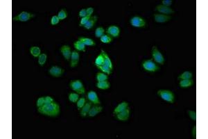 Immunofluorescent analysis of HepG2 cells using ABIN7167968 at dilution of 1:100 and Alexa Fluor 488-congugated AffiniPure Goat Anti-Rabbit IgG(H+L) (ARHGEF12 抗体  (AA 1302-1501))
