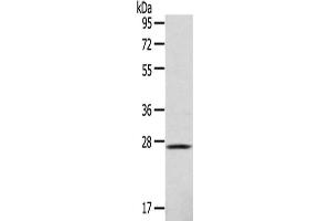 Gel: 10 % SDS-PAGE,Lysate: 40 μg,Primary antibody: ABIN7128967(CLEC4D Antibody) at dilution 1/123 dilution,Secondary antibody: Goat anti rabbit IgG at 1/8000 dilution,Exposure time: 1 minute