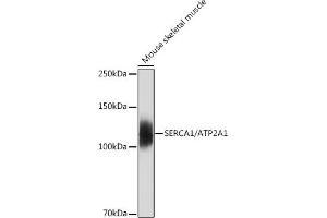 Western blot analysis of extracts of Mouse skeletal muscle, using SERC/ Rabbit mAb (9639) at 1:500 dilution. (ATP2A1/SERCA1 抗体)