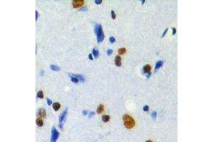 Immunohistochemical analysis of MKI67IP (pT234) staining in human brain formalin fixed paraffin embedded tissue section. (NIFK 抗体  (pSer234))