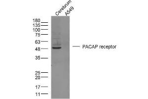 Mouse brain lysates and Human A549 cells probed with PACAP receptor 1 Polyclonal Antibody, unconjugated  at 1:300 overnight at 4°C followed by a conjugated secondary antibody at 1:10000 for 90 minutes at 37°C. (ADCYAP1R1 抗体  (AA 251-330))