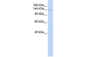Western Blotting (WB) image for anti-Class II, Major Histocompatibility Complex, Transactivator (CIITA) (Middle Region) antibody (ABIN2780332)