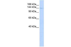 WB Suggested Anti-CIITA Antibody Titration:  0. (CIITA 抗体  (Middle Region))