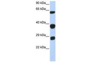 Image no. 1 for anti-Small Nuclear Ribonucleoprotein Polypeptides B and B1 (SNRPB) (AA 72-121) antibody (ABIN6740670)