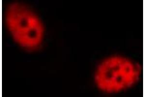 ABIN6267455 staining RAW264. (SHP1 抗体  (pTyr536))