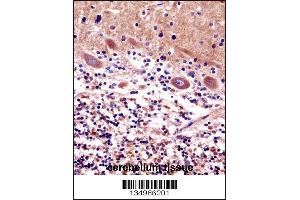 CDR2 Antibody immunohistochemistry analysis in formalin fixed and paraffin embedded human cerebellum tissue followed by peroxidase conjugation of the secondary antibody and DAB staining. (CDR2 抗体  (C-Term))