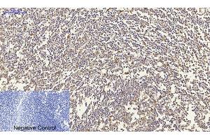 Immunohistochemical analysis of paraffin-embedded human tonsil tissue. (N-Cadherin 抗体  (AA 690-770))